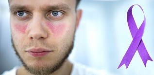 אילוסטרציה/שאטרסטוק/הפריחה מזכירה את הכתמים על פניו של זאב